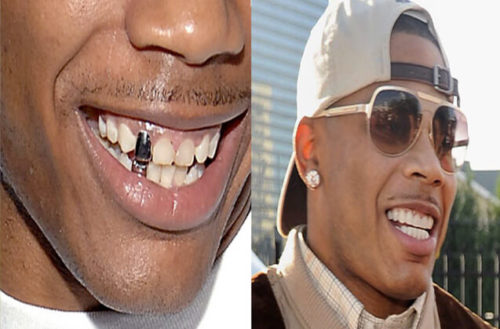 Correct-Your-Dental-Flaws-and-Smile-with-Confidence